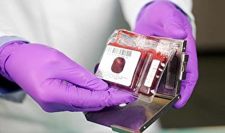 مزایای استفاده از خون بندناف برای درمان بیماری چیست؟ 