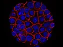 درمان سرطان‌های مغز و ریه با استفاده از سلول‌های بنیادی